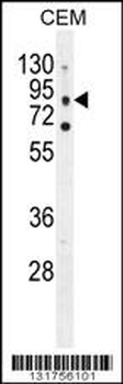 CLCN7 Antibody (C-term)