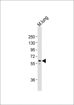 TGFBR2 Antibody (N-term)