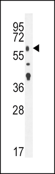 TGFBR2 Antibody (N-term)