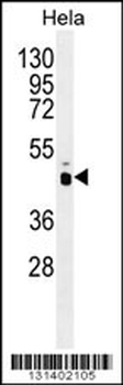 PRKAG1 Antibody (N-term)