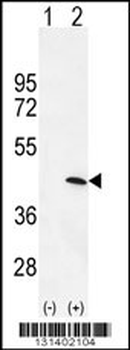 PRKAG1 Antibody (N-term)