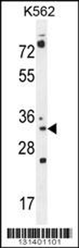 PYCR2 Antibody (Center)