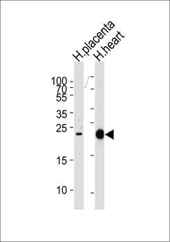 FRAT2 Antibody (C-term)