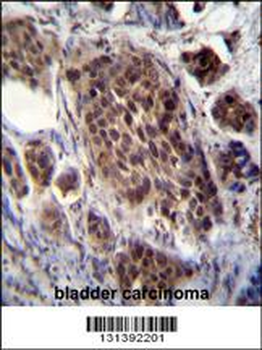 FRAT2 Antibody (C-term)