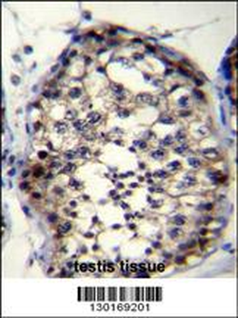 ROPN1L Antibody (N-term)