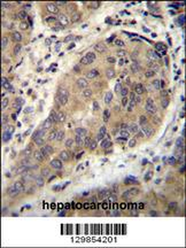 WTIP Antibody (C-term)