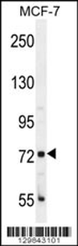 CTGE4 Antibody (N-term)