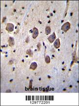 ANKRD34C Antibody (C-term)