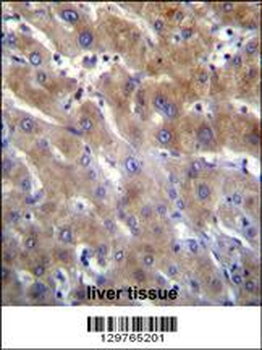 ANKRD18B Antibody (N-term)