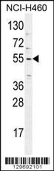 TRIM65 Antibody (Center)