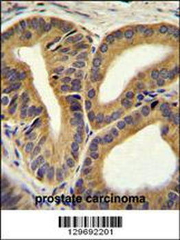 TRIM65 Antibody (Center)