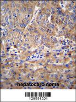 DEF Antibody (N-term)