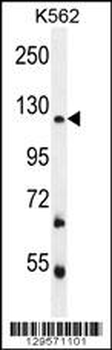 FBRSL1 Antibody (C-term)