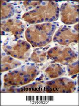 LRWD1 Antibody (N-term)
