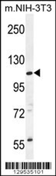 CCDC158 Antibody (C-term)