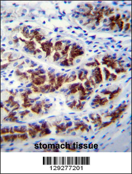 PTPN20A Antibody (Center)