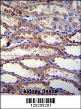 SHISA3 Antibody (C-term)