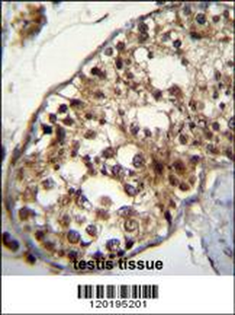 NUP160 Antibody (Center)
