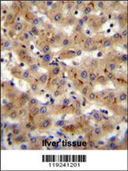 CSAD Antibody (Center)