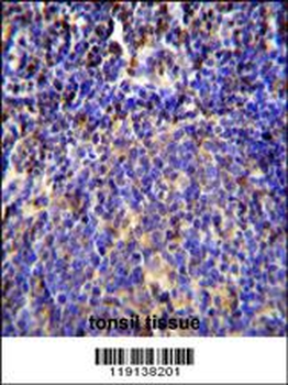 S100A4 Antibody (N-term)