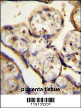 TBB1 Antibody (N-term)