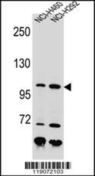 NBN Antibody (C-term)