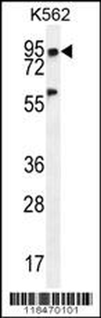 PLEKHA4 Antibody (N-term)