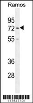 HMMR Antibody (C-term)