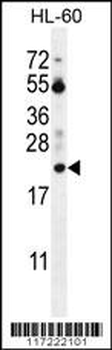 PTMA Antibody (N-term)