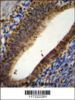 PTMA Antibody (N-term)