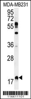RHEB Antibody (C-term)