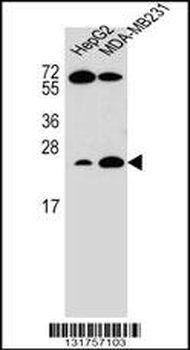 RHOJ Antibody (Center)