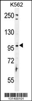 TAS1R2 Antibody (C-term)