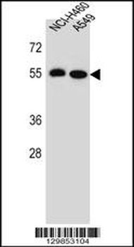 LRRC6 Antibody (Center)