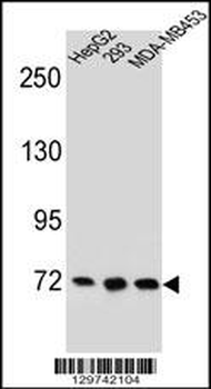 ZNF860 Antibody (C-term)