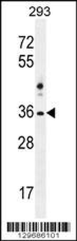 NKX1-2 Antibody (N-term)