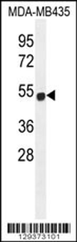 ZNF286B Antibody (N-term)