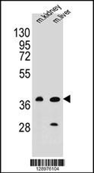 BRUNOL6 Antibody (N-term)