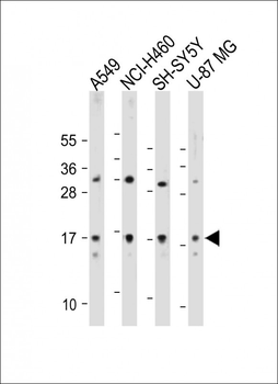 TMEM100 Antibody (C-term)