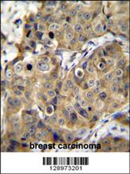 TMEM100 Antibody (C-term)