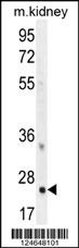 HOXB6 Antibody (Center)