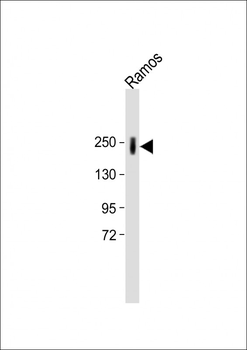 PTPRC Antibody (N-term)