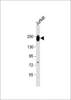 PTPRC Antibody (N-term)