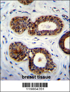 QTRTD1 Antibody (C-term)
