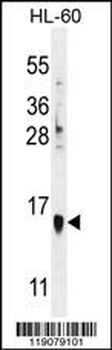 MART-1/Melan-A Antibody (Center)