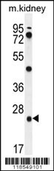 PGPEP1 Antibody (N-term)