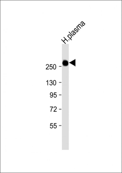ITIH1 Antibody (Center)