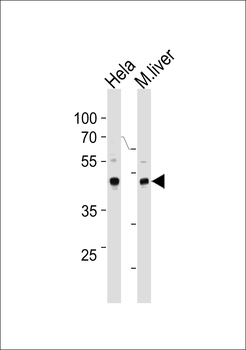 TBX6 Antibody (Center W158)