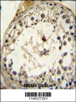 GDF6 Antibody (N-term)