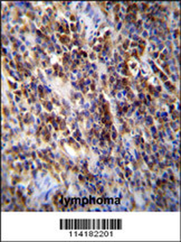 Parp9 Antibody (C-term)